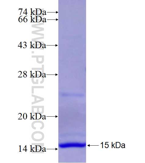 A2ML1 fusion protein Ag27014 SDS-PAGE