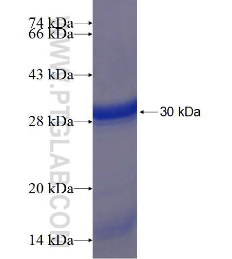 A4GNT fusion protein Ag18432 SDS-PAGE