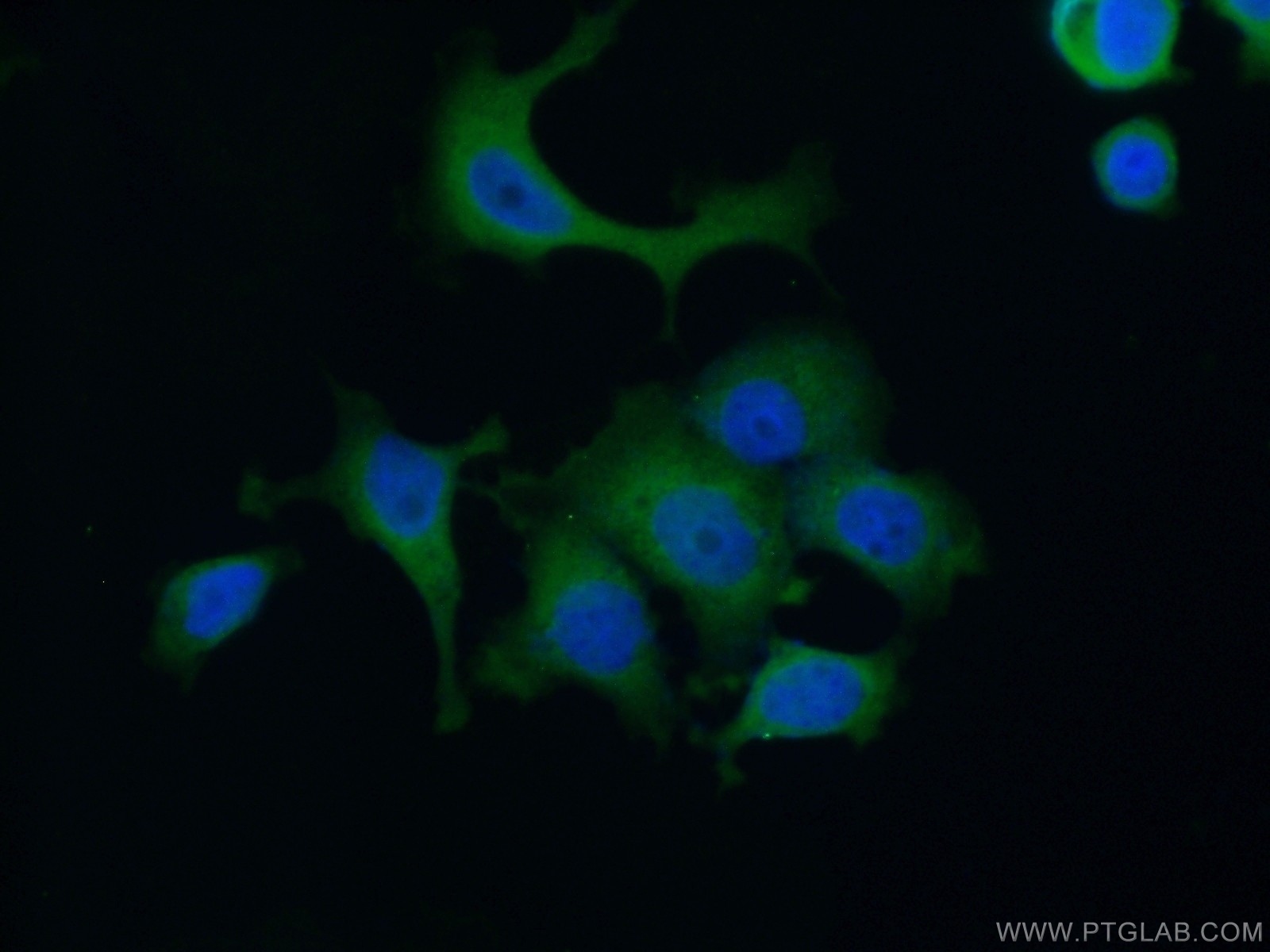 IF Staining of MCF-7 using 13815-1-AP