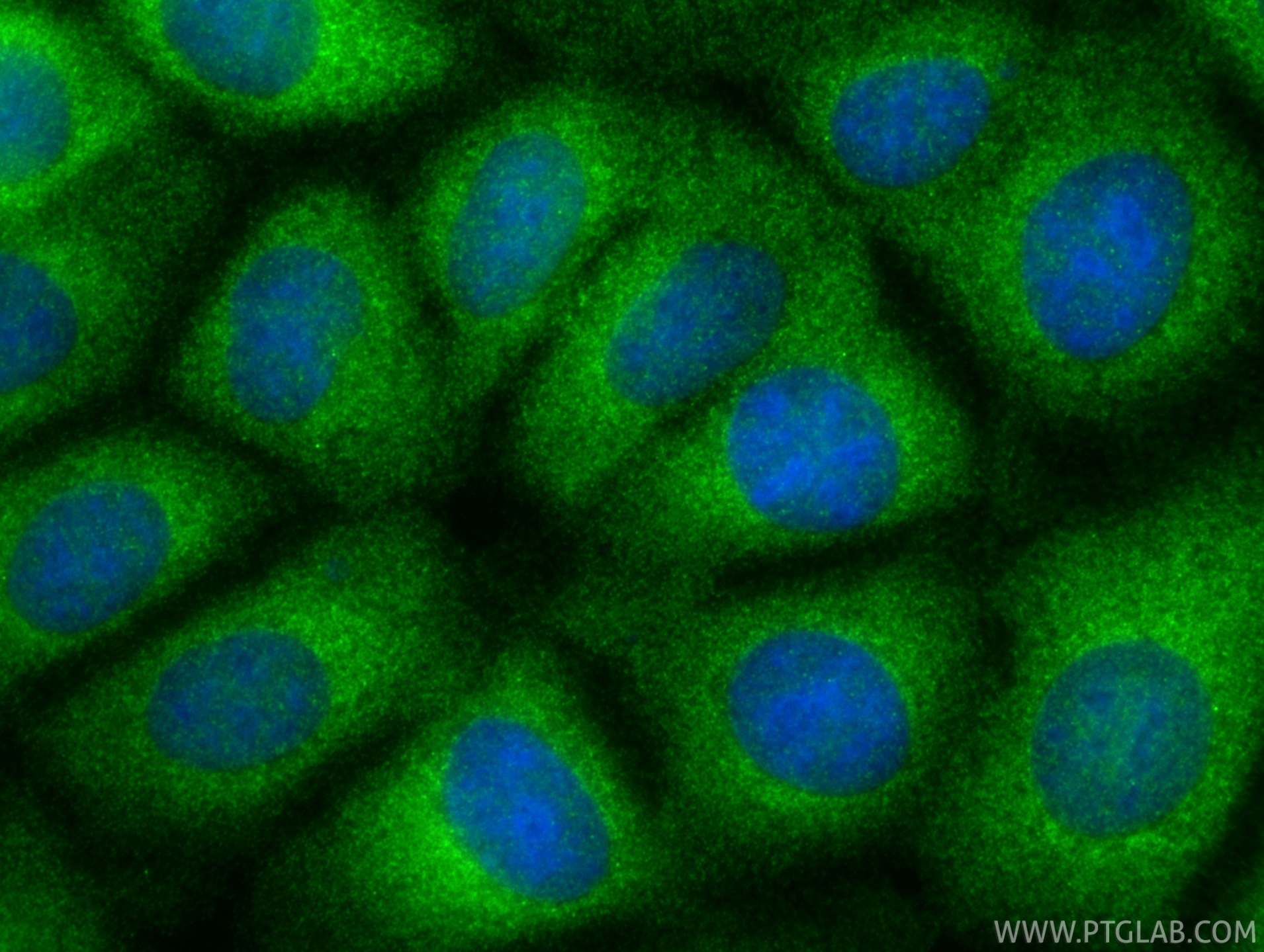 IF Staining of MCF-7 using 13815-1-AP IF Staining of MCF-7 using 13815-1-AP