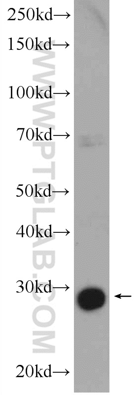 WB analysis of mouse heart using 13815-1-AP