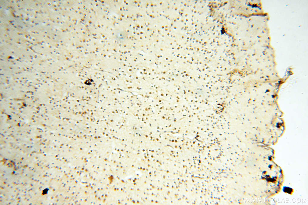 IHC staining of human brain using 14021-1-AP