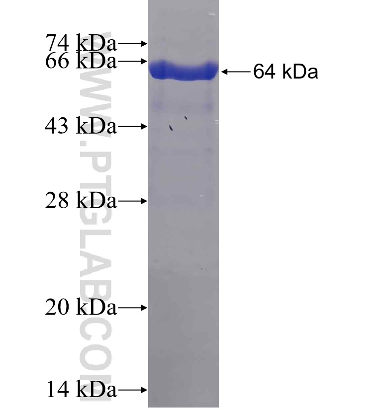 AADAT fusion protein Ag3676 SDS-PAGE
