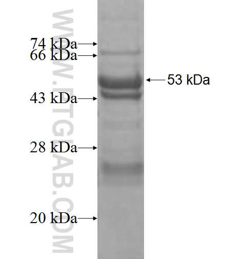 AAK1 fusion protein Ag7599 SDS-PAGE AAK1 fusion protein Ag7599 SDS-PAGE