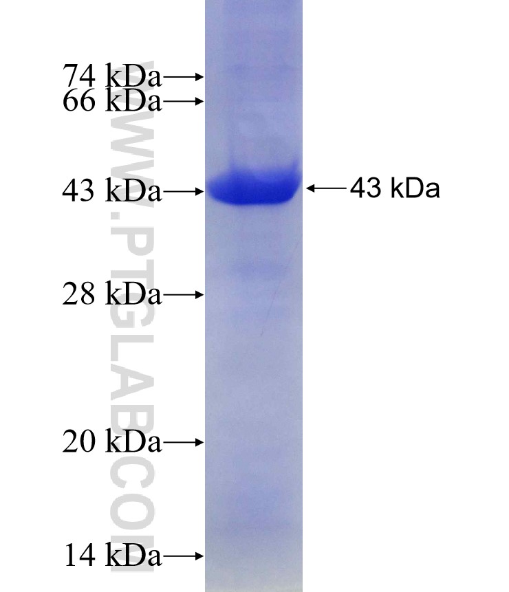 AAMP fusion protein Ag15861 SDS-PAGE AAMP fusion protein Ag15861 SDS-PAGE