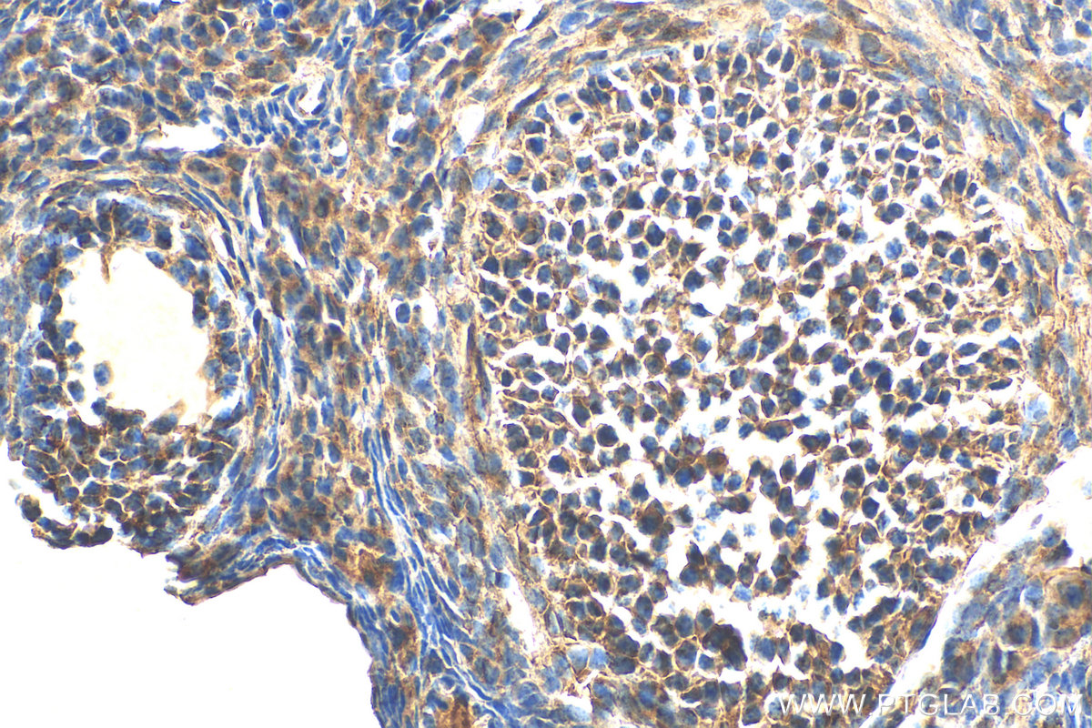 IHC staining of mouse ovary using 17990-1-AP