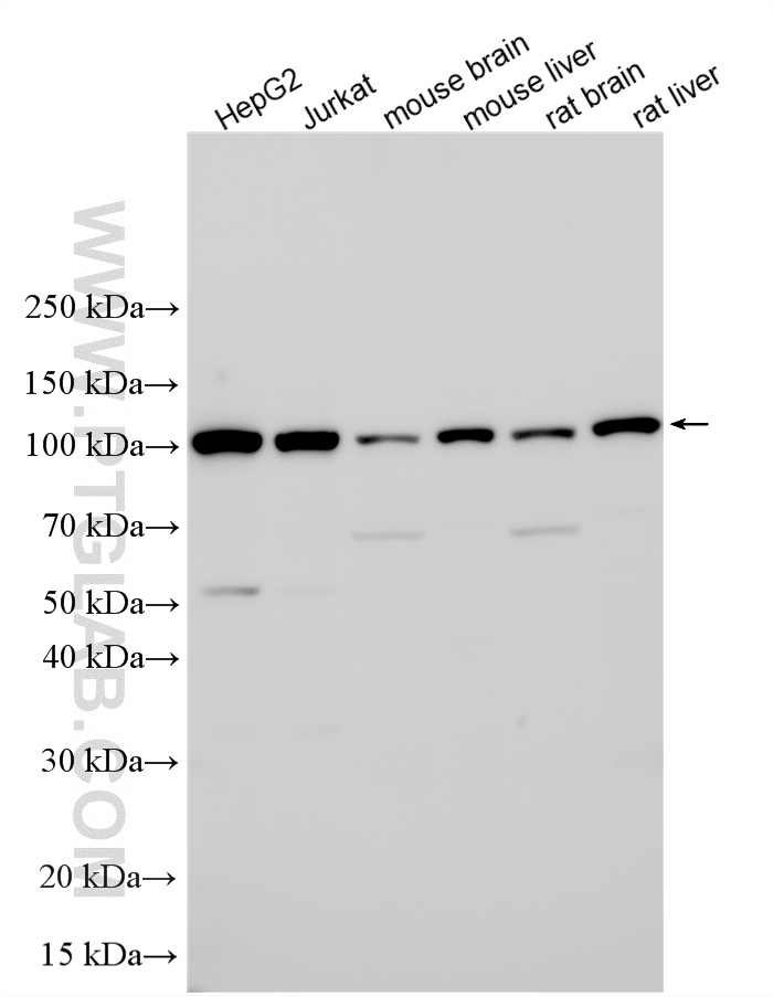 Various lysates were subjected to SDS PAGE followed by western blot with 17394-1-AP (AlaRS antibody) at dilution of 1:8000 incubated at room temperature for 1.5 hours. WB analysis using 17394-1-AP