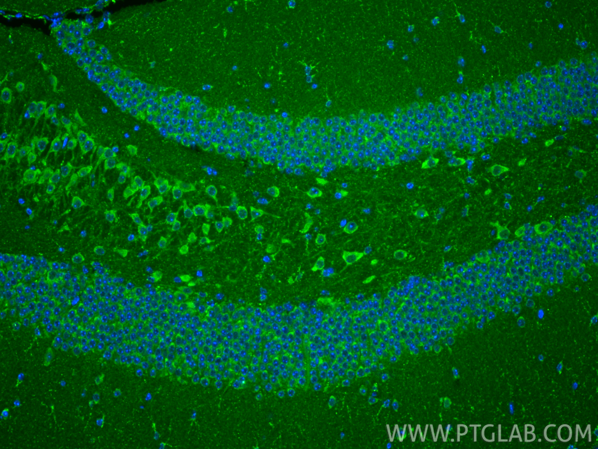 IF Staining of mouse brain using 22696-1-AP IF Staining of mouse brain using 22696-1-AP