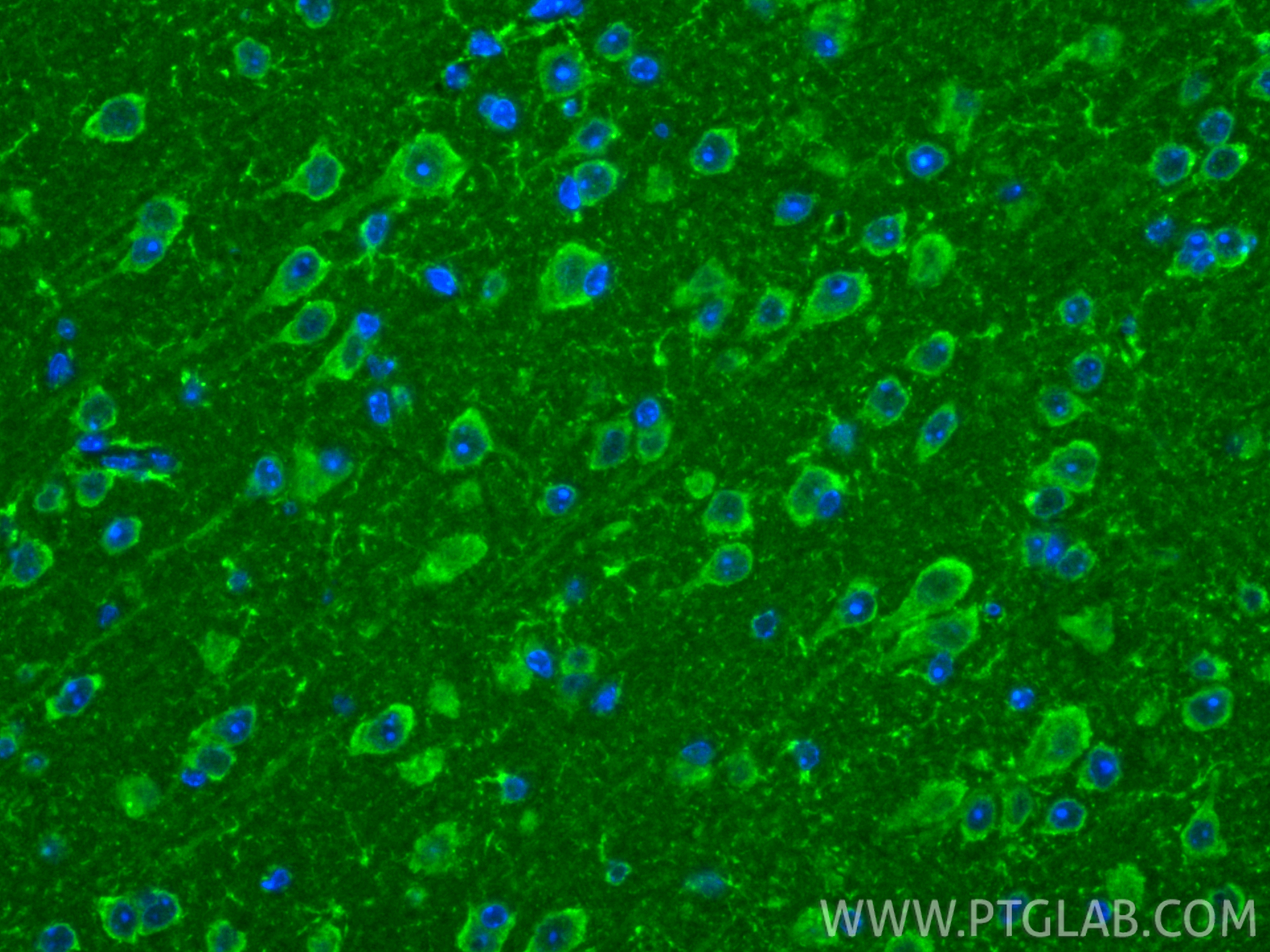 IF Staining of mouse brain using 22696-1-AP IF Staining of mouse brain using 22696-1-AP