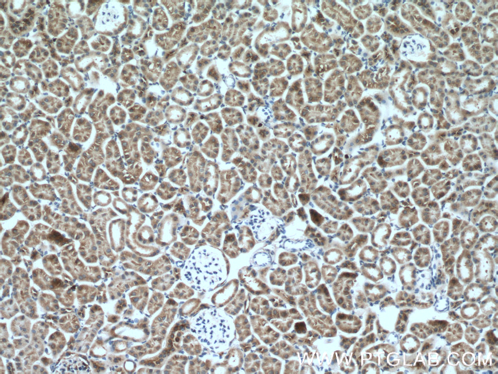IHC staining of mouse kidney using 14900-1-AP