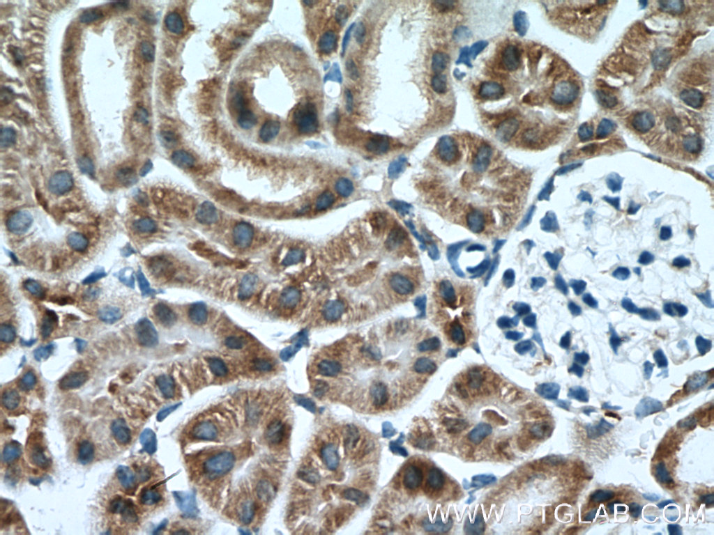 IHC staining of mouse kidney using 14900-1-AP