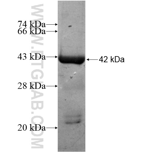 AASDH fusion protein Ag15678 SDS-PAGE