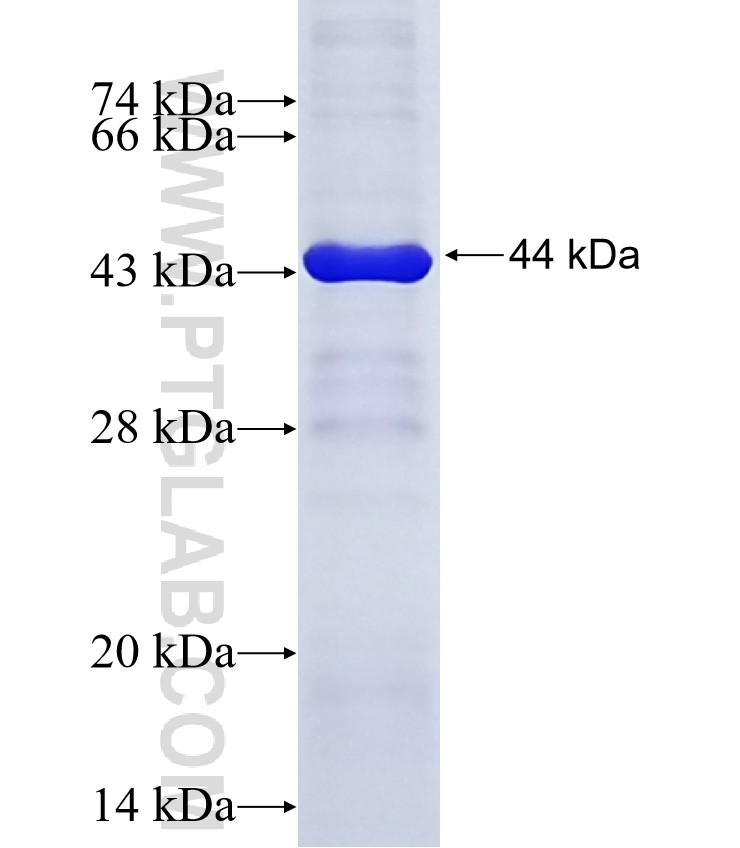 AASDH fusion protein Ag15678 SDS-PAGE