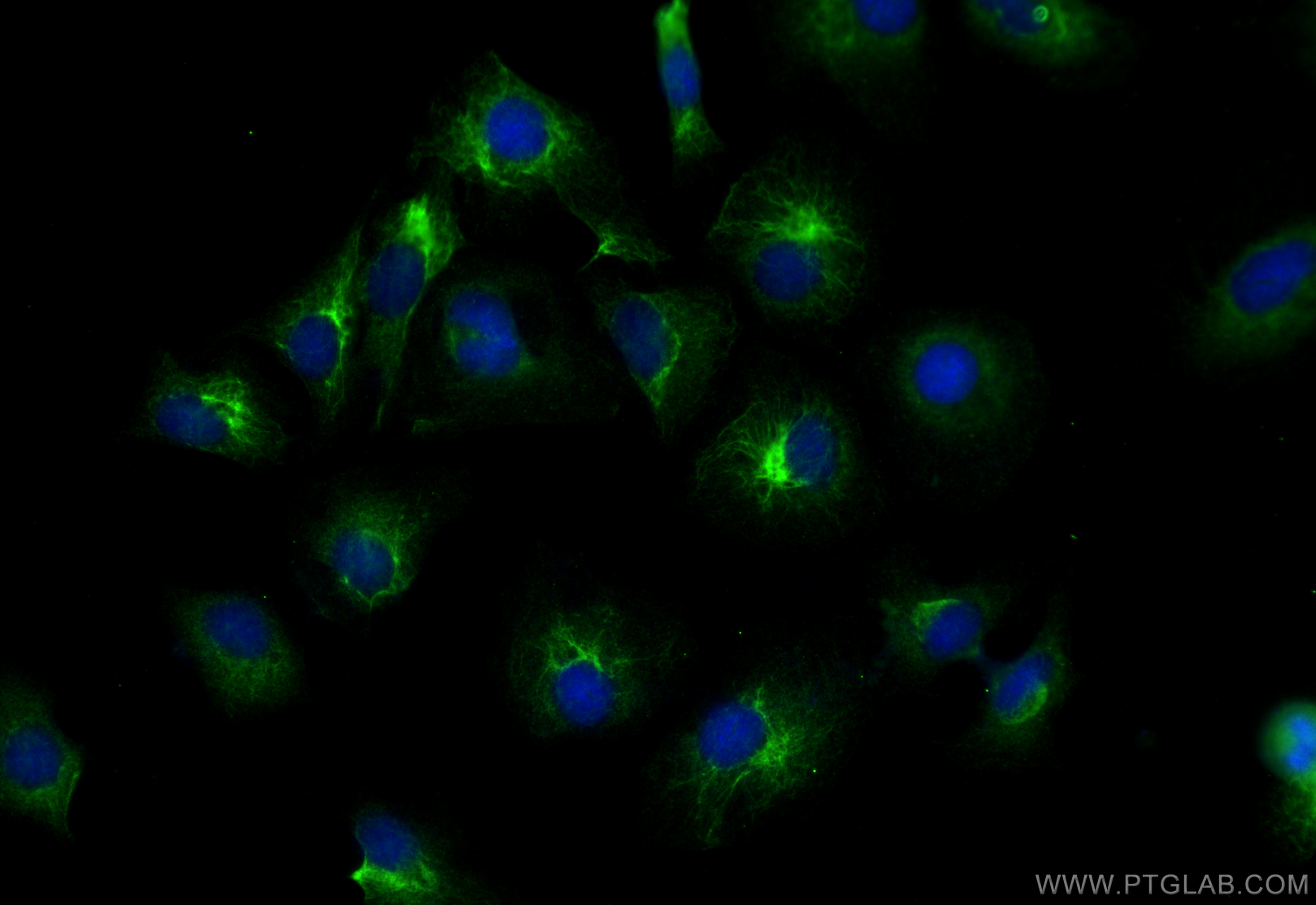 IF Staining of HeLa using 11244-1-AP