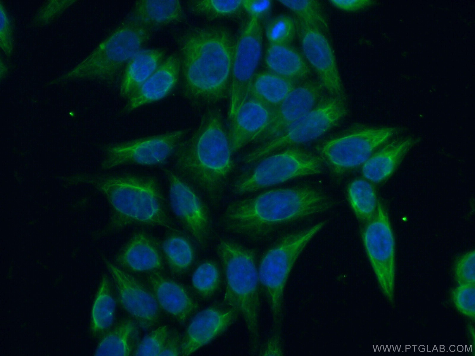 IF Staining of HeLa using 11244-1-AP