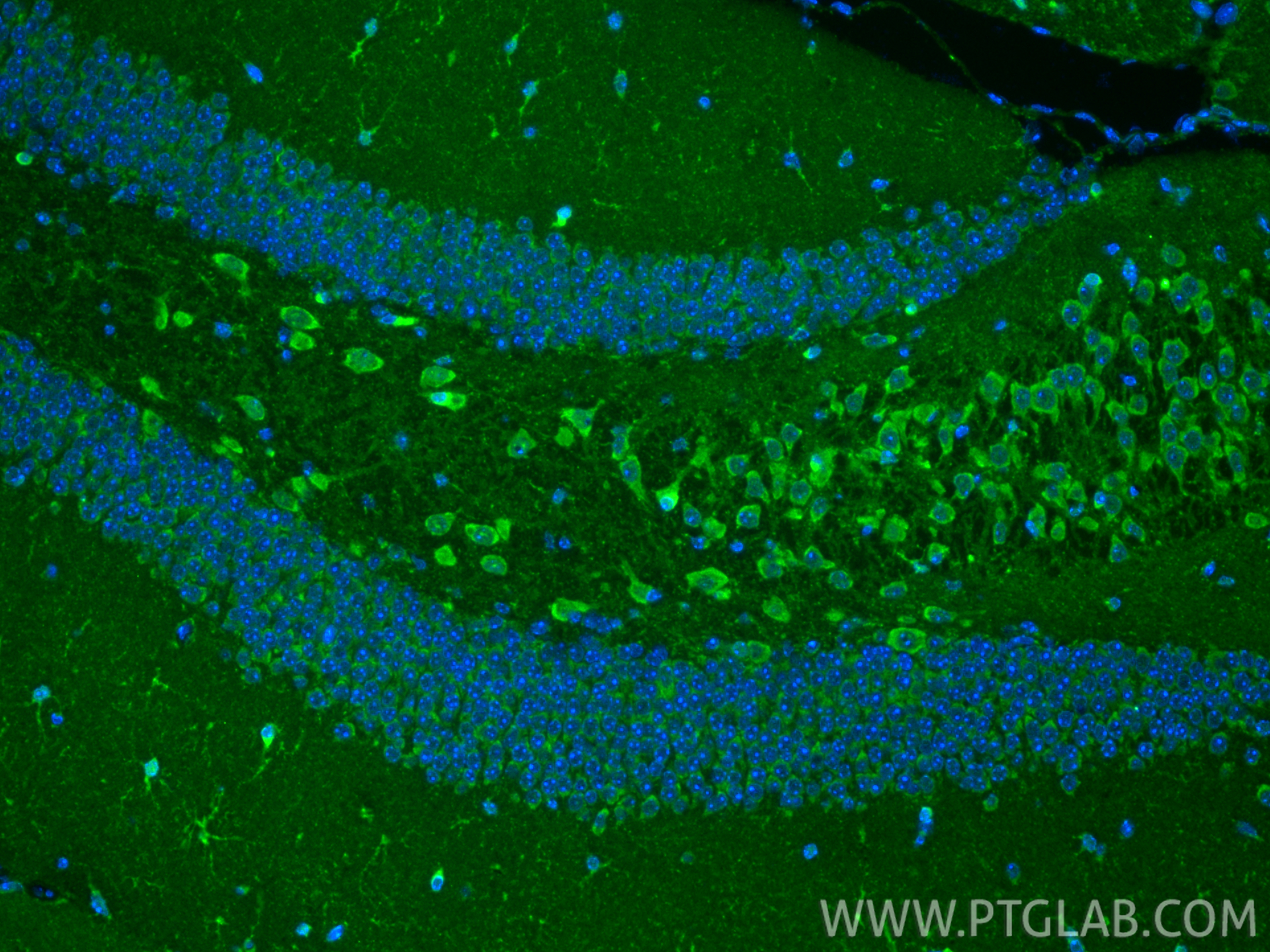 IF Staining of mouse brain using 29354-1-AP
