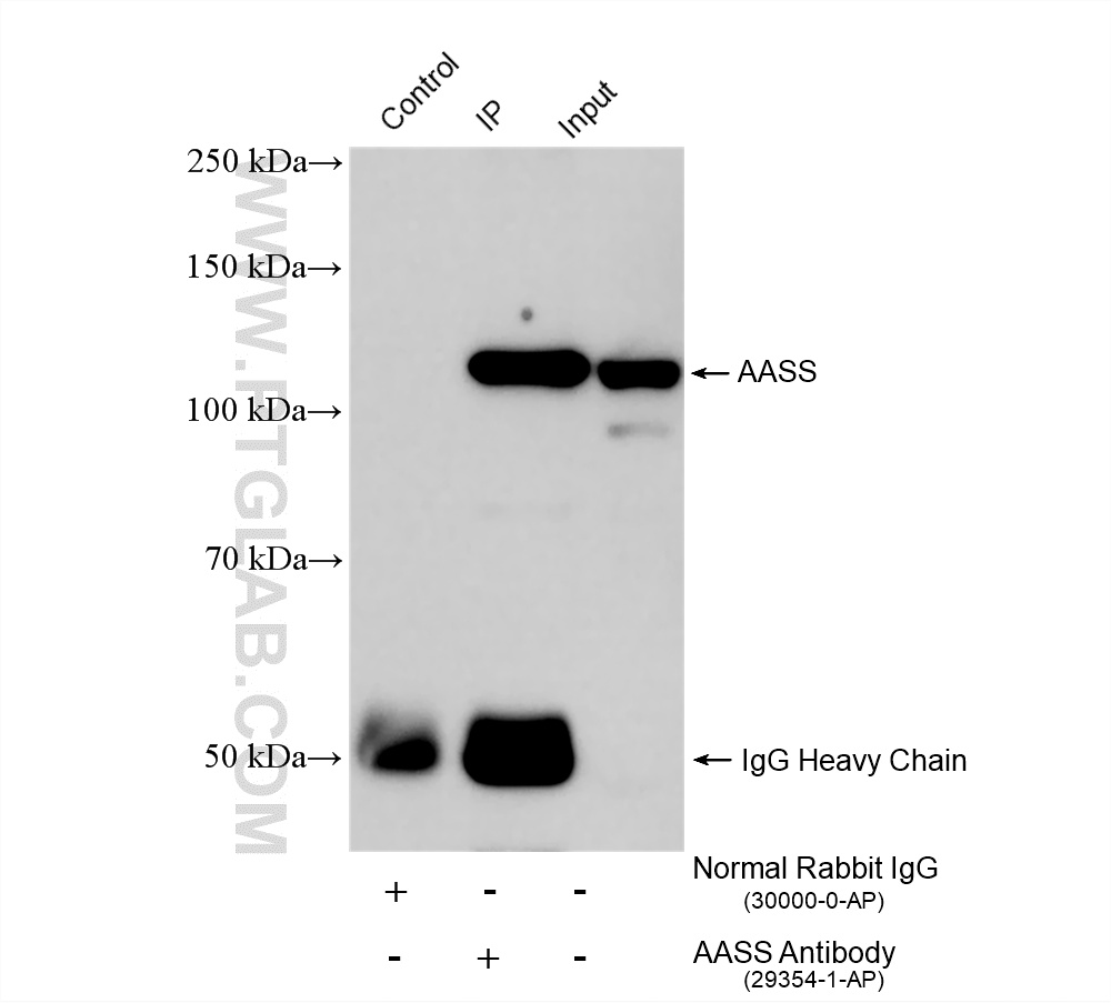 IP experiment of mouse liver using 29354-1-AP
