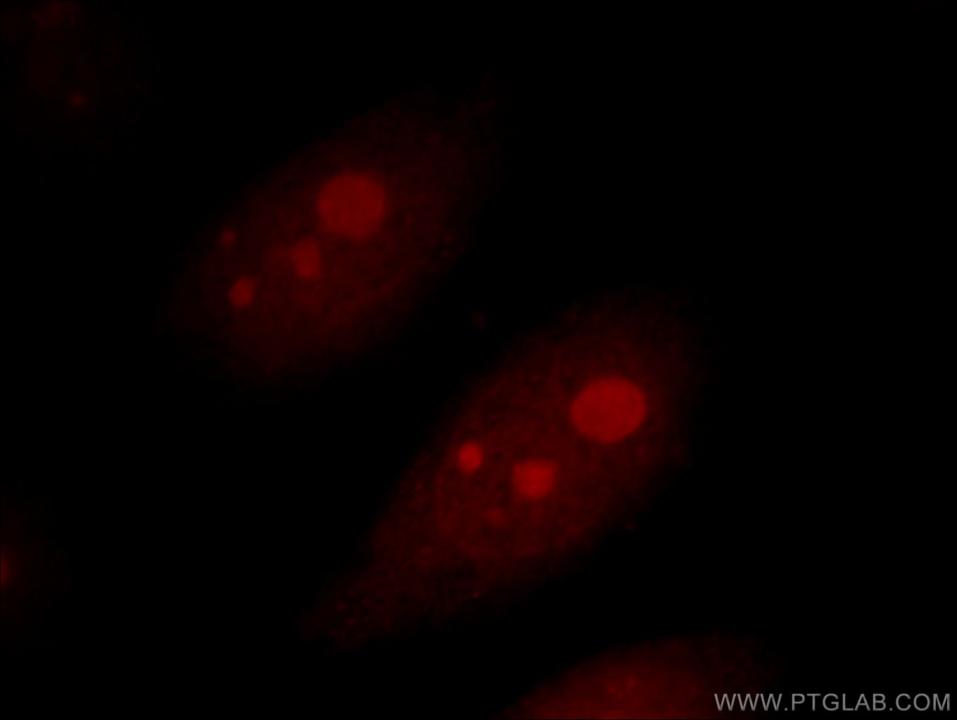 IF Staining of HeLa using 10282-1-AP