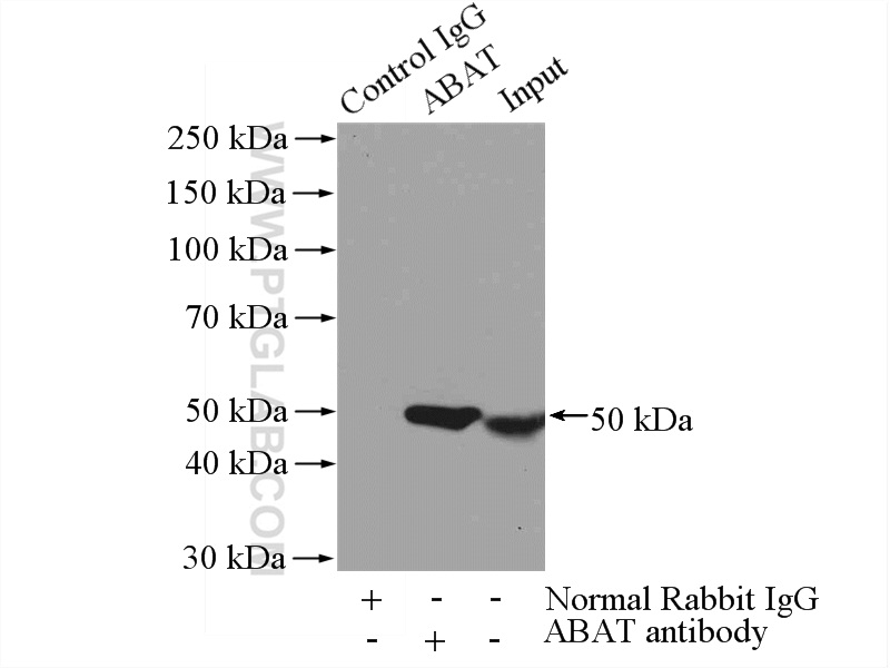 IP experiment of mouse liver using 11349-1-AP