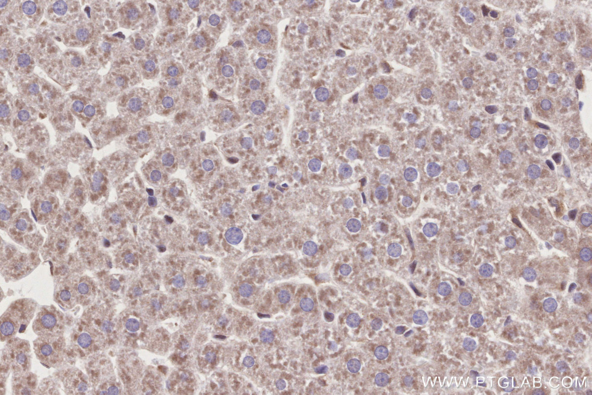 IHC staining of rat liver using 26564-1-AP