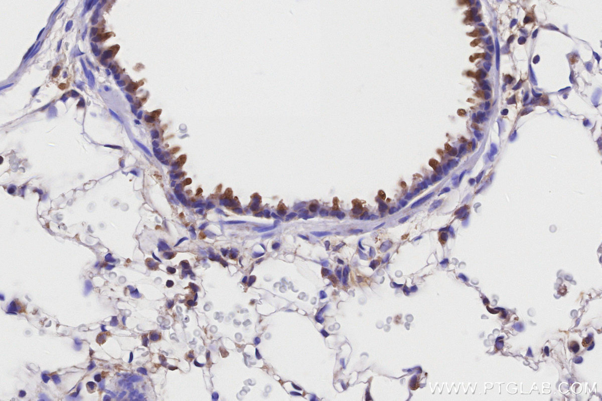 IHC staining of rat lung using 26564-1-AP