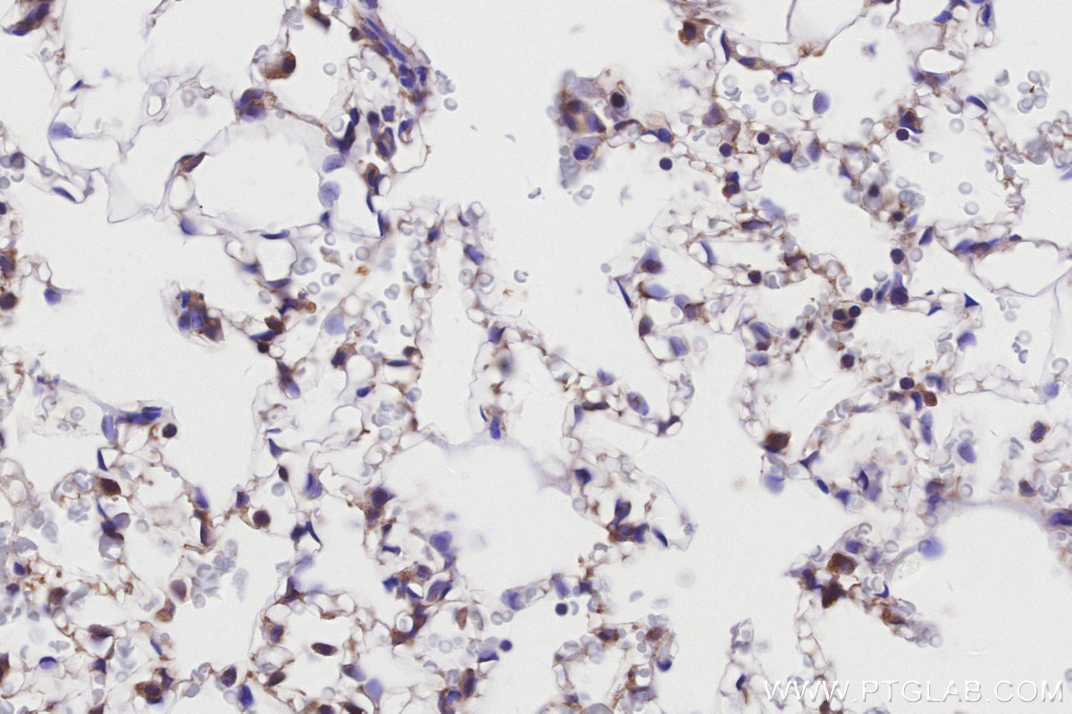 IHC staining of rat lung using 26564-1-AP