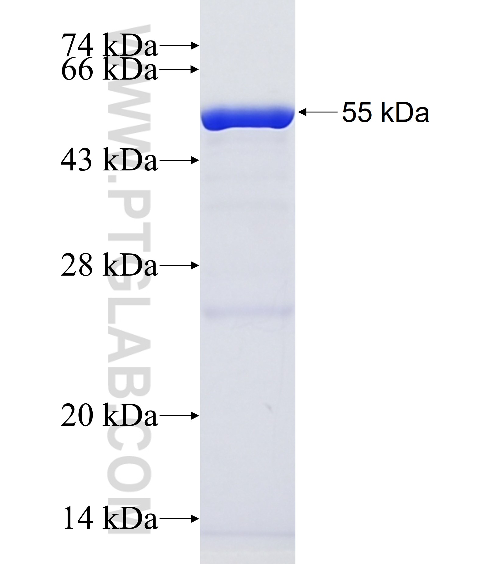 ABCA1 fusion protein Ag37398 SDS-PAGE ABCA1 fusion protein Ag37398 SDS-PAGE