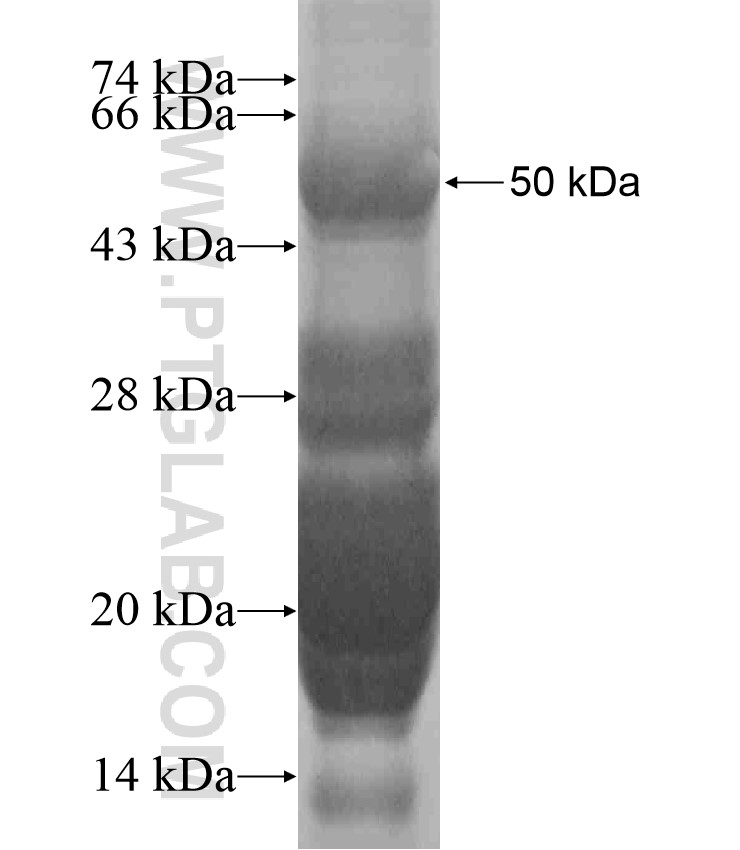 ABCA11P fusion protein Ag18458 SDS-PAGE ABCA11P fusion protein Ag18458 SDS-PAGE