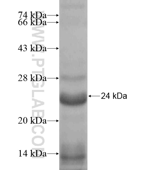 ABCA11P fusion protein Ag19276 SDS-PAGE ABCA11P fusion protein Ag19276 SDS-PAGE