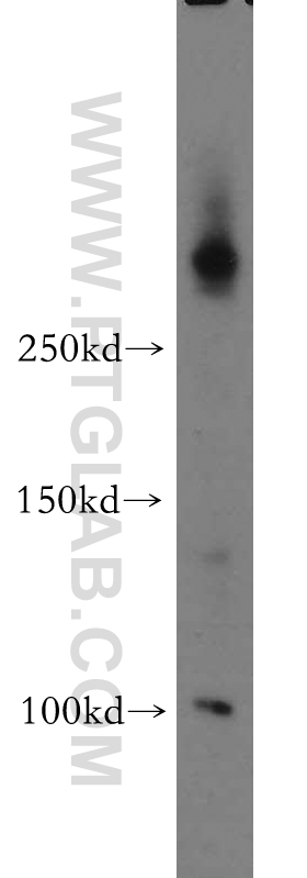 WB analysis of mouse thymus using 20681-1-AP