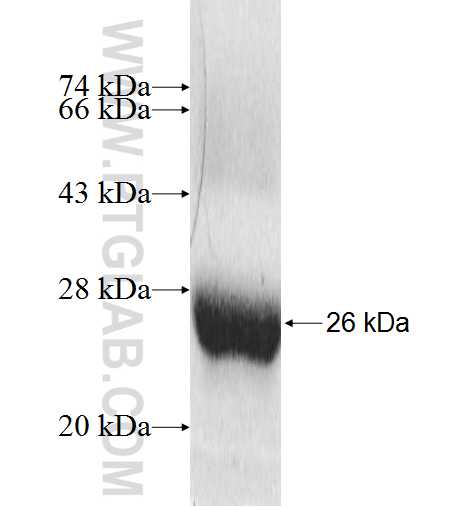 ABCA3 fusion protein Ag9810 SDS-PAGE ABCA3 fusion protein Ag9810 SDS-PAGE