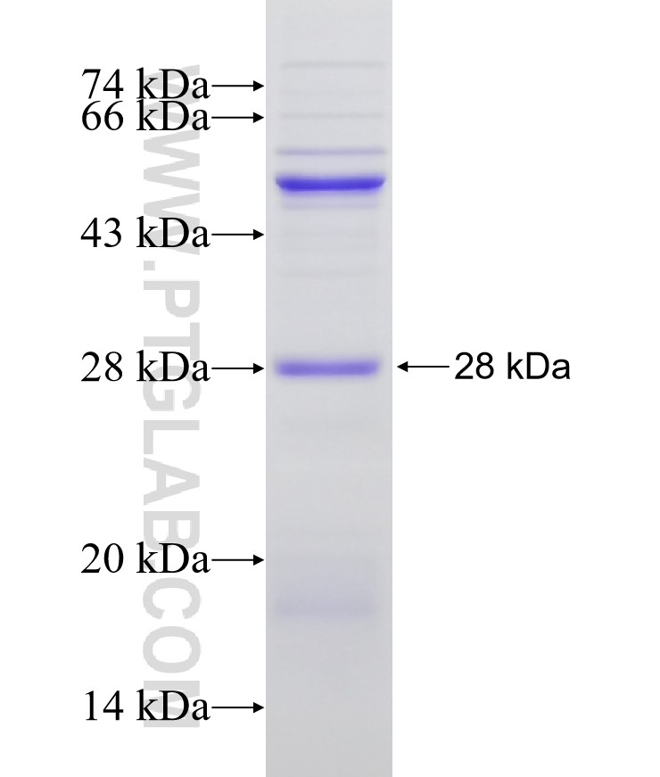 ABCA5 fusion protein Ag21956 SDS-PAGE