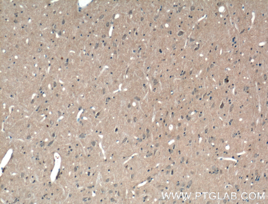 IHC staining of rat brain using 25339-1-AP (same clone as 25339-1-PBS)