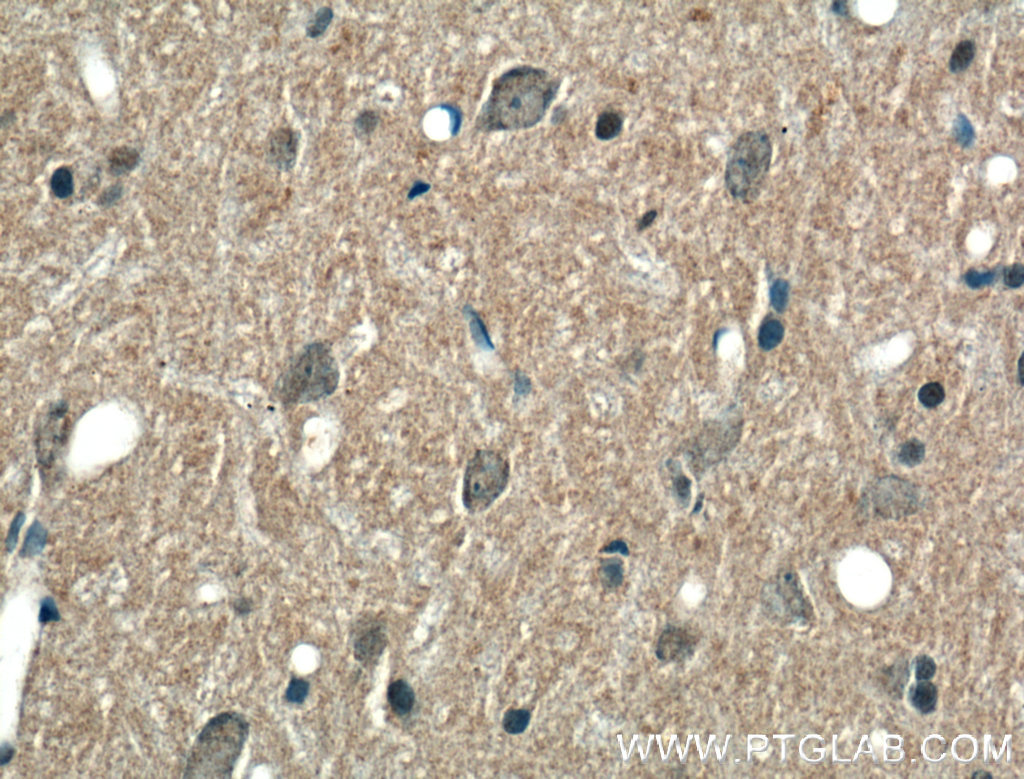 IHC staining of rat brain using 25339-1-AP (same clone as 25339-1-PBS)