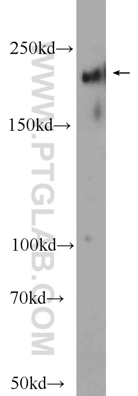 WB analysis of mouse brain using 25339-1-AP