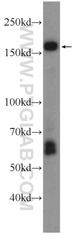 WB analysis of mouse brain using 24351-1-AP