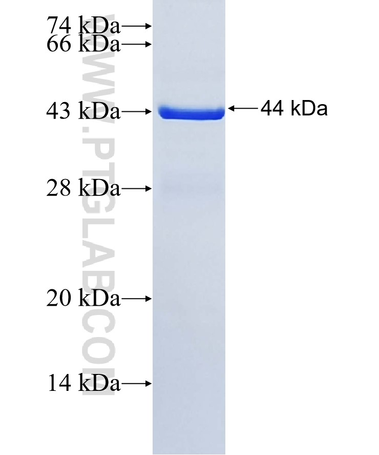 ABCA9 fusion protein Ag35032 SDS-PAGE