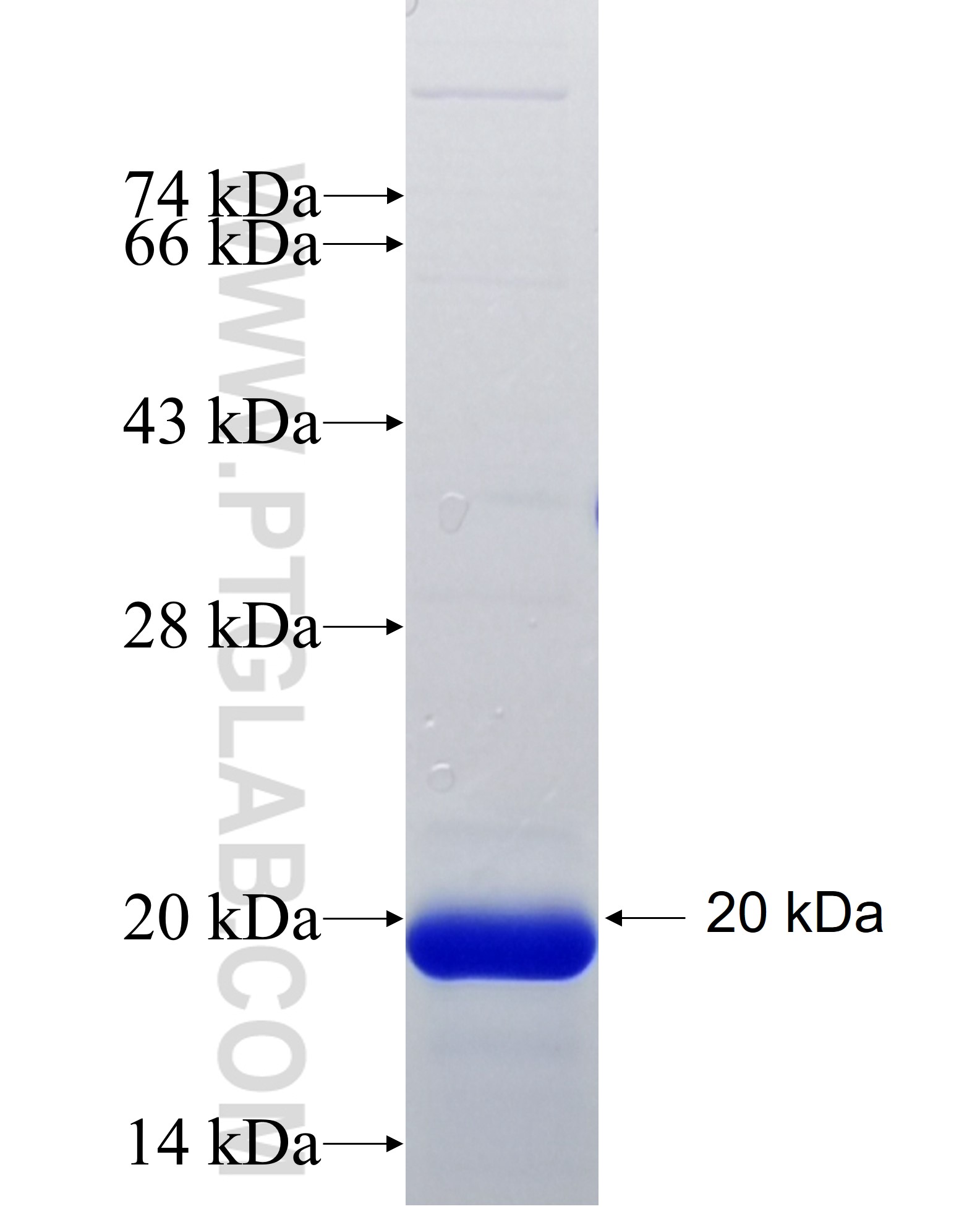 ABCA9 fusion protein Ag35045 SDS-PAGE