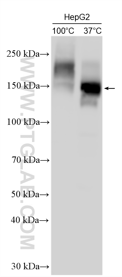 WB analysis using 22336-1-AP