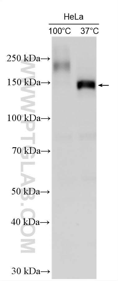 WB analysis using 22336-1-AP