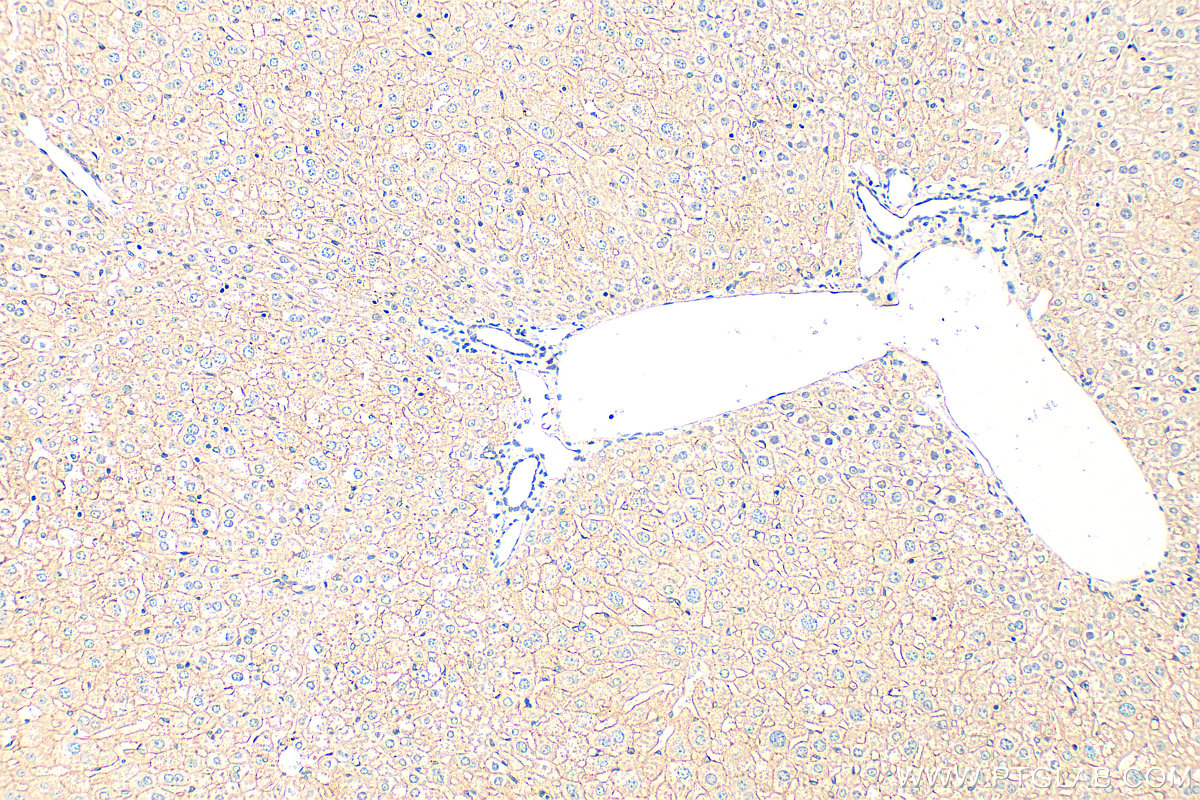 IHC staining of mouse liver using 14628-1-AP
