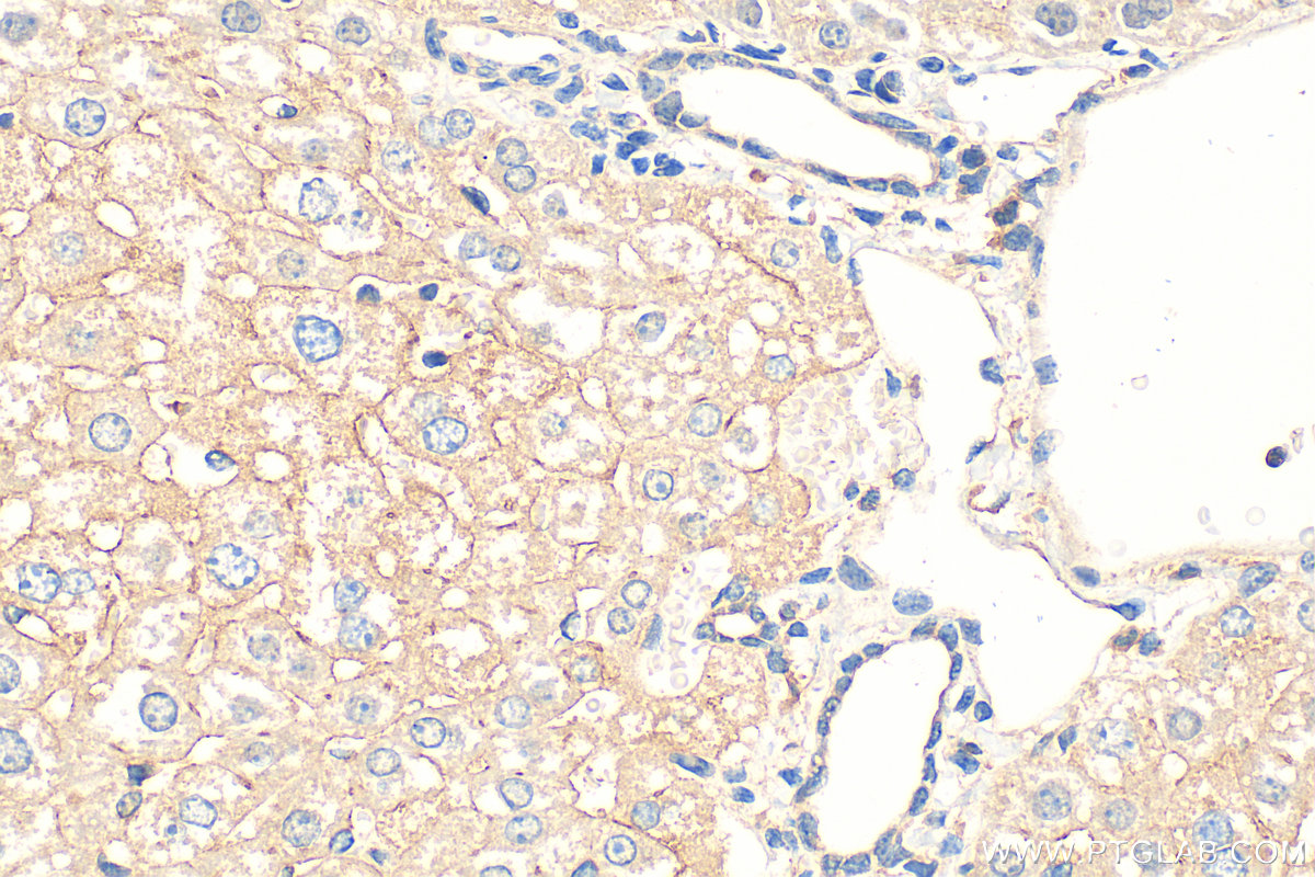 IHC staining of mouse liver using 14628-1-AP