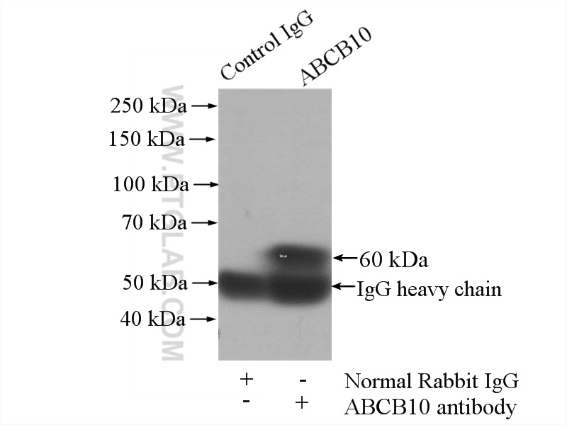 IP experiment of K-562 using 14628-1-AP