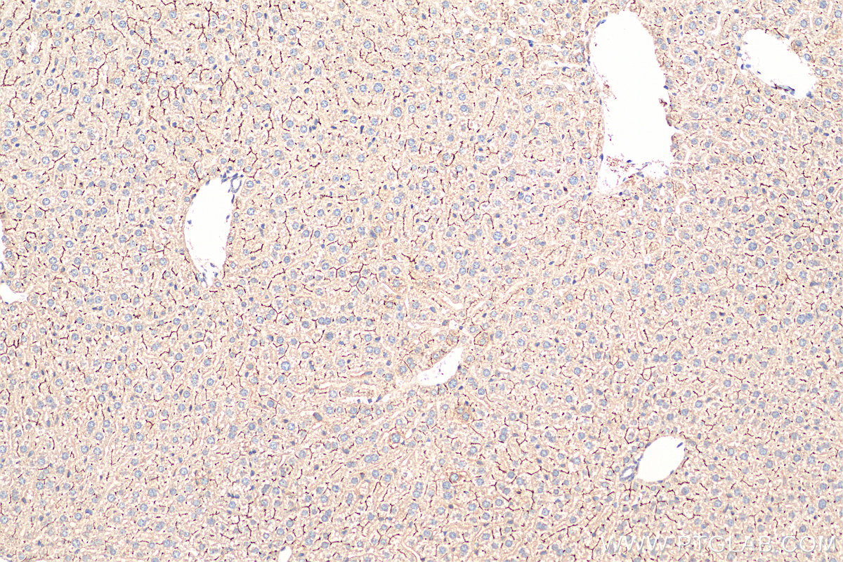 IHC staining of mouse liver using 18990-1-AP