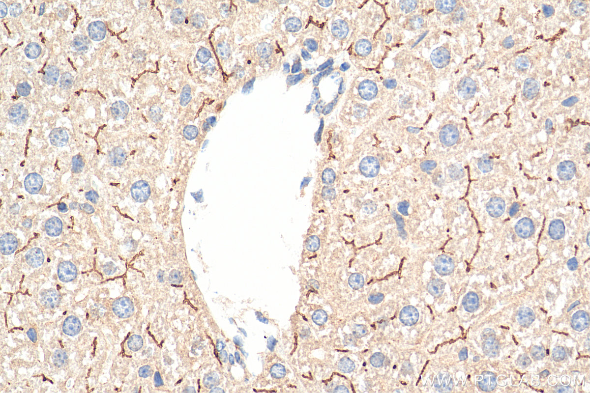 IHC staining of mouse liver using 18990-1-AP