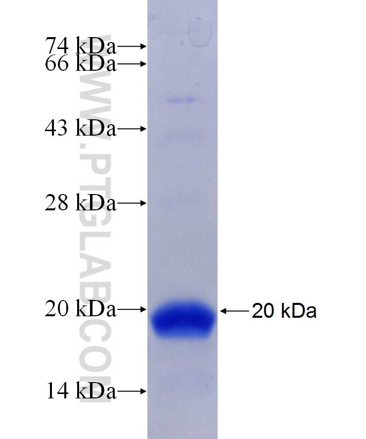 ABCB11 fusion protein Ag29641 SDS-PAGE ABCB11 fusion protein Ag29641 SDS-PAGE