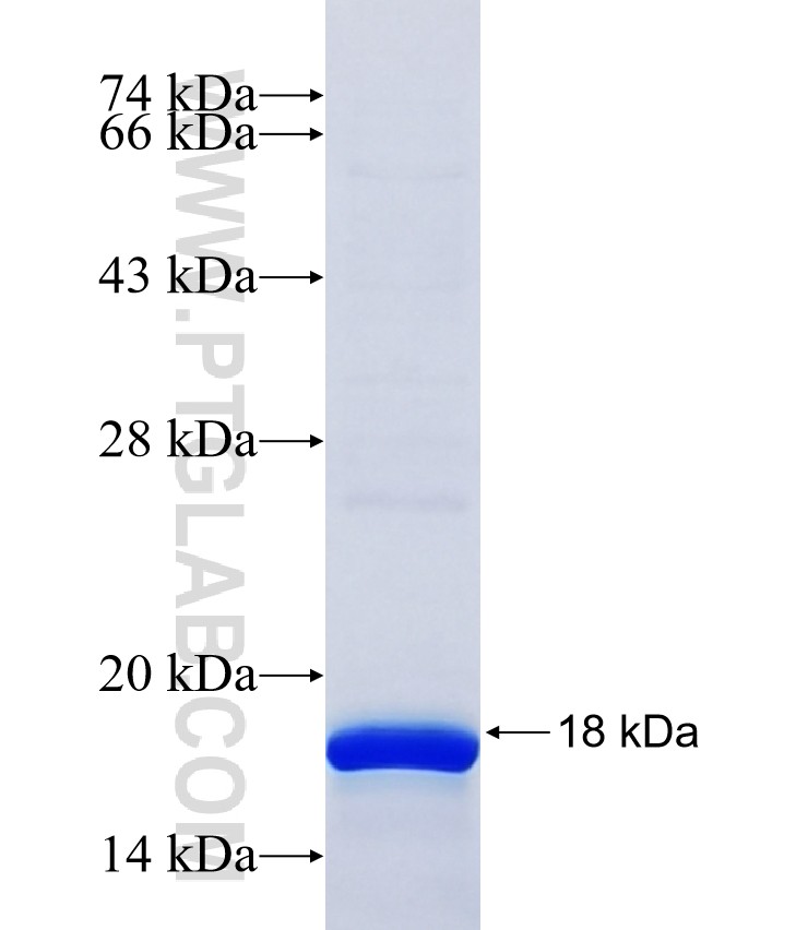 ABCB4 fusion protein Ag26858 SDS-PAGE ABCB4 fusion protein Ag26858 SDS-PAGE