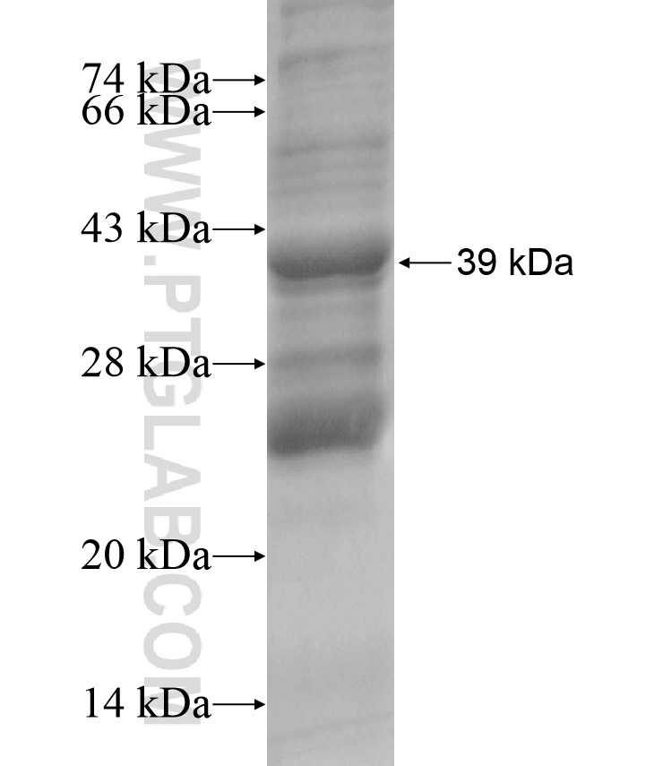ABCB5 fusion protein Ag17572 SDS-PAGE