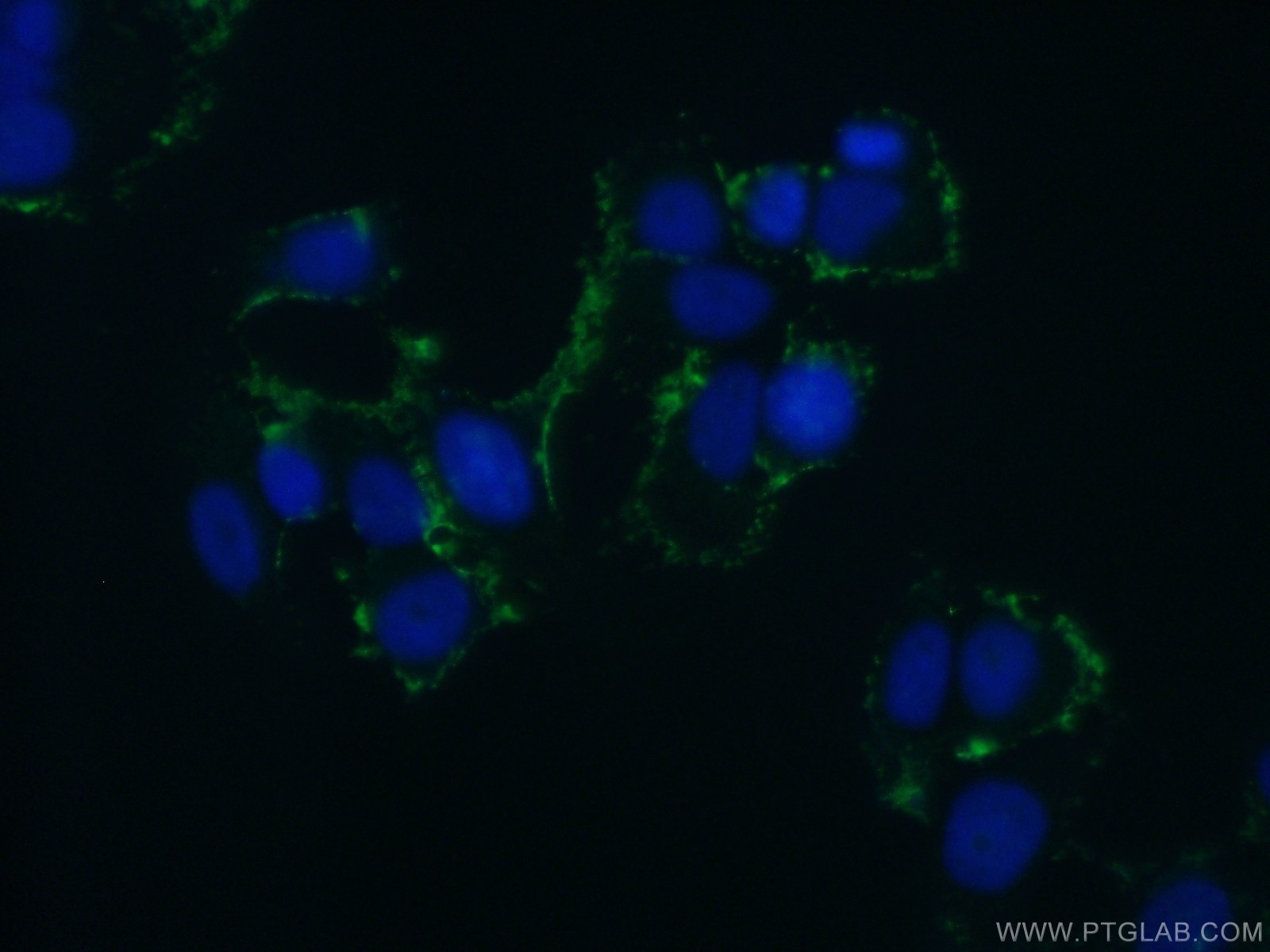 IF Staining of MCF-7 using 51007-1-AP (same clone as 51007-1-PBS)