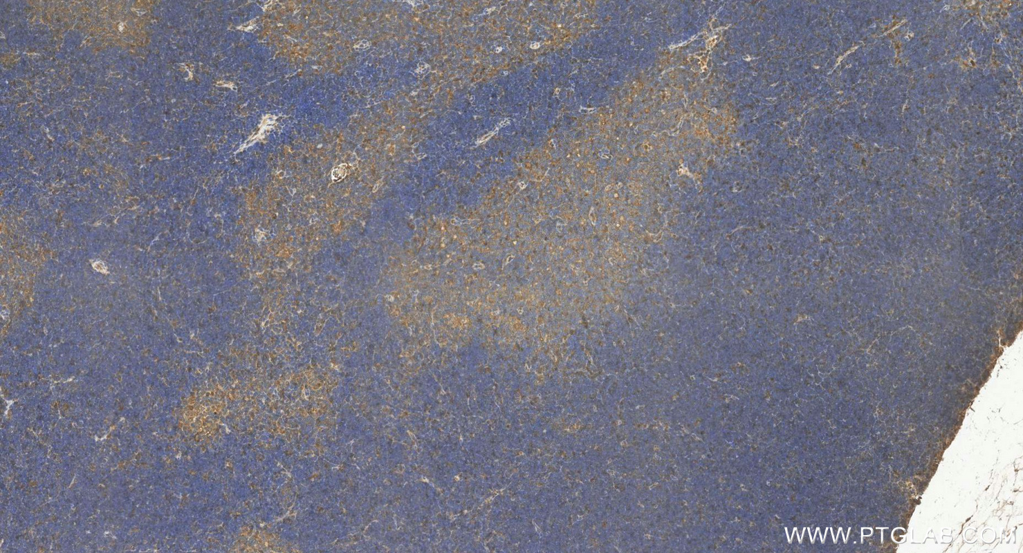 IHC staining of mouse thymus using 11158-1-AP IHC staining of mouse thymus using 11158-1-AP